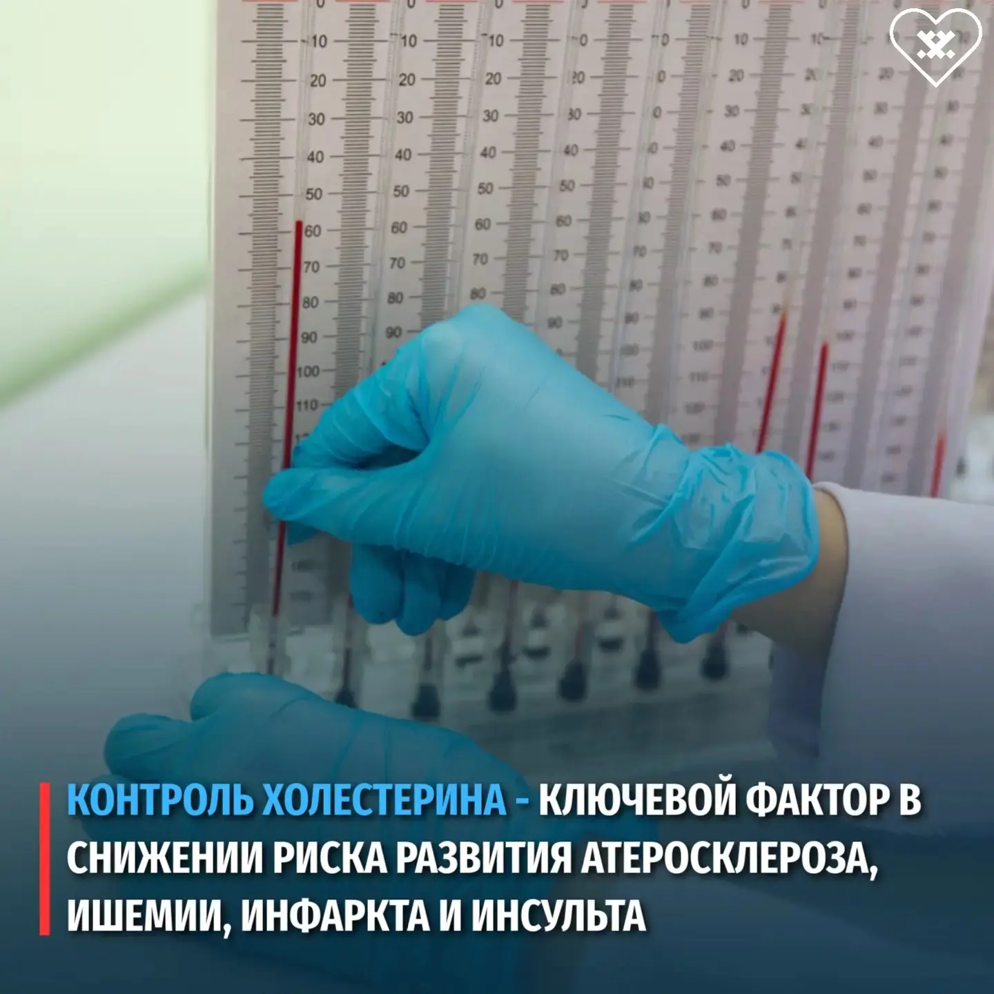 Дорогие ямальцы!  С начала года в восьми городах округа действует проект по ранней диагностике серде