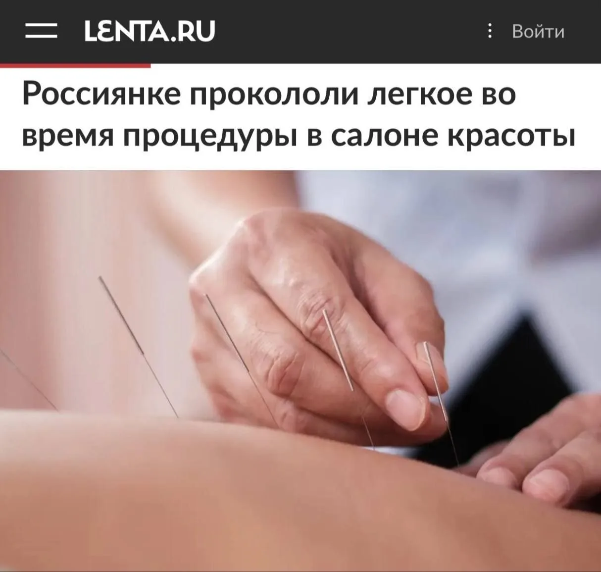 ❗️"Россиянке прокололи легкое во время процедуры в салоне красоты": Травму девушка полу...