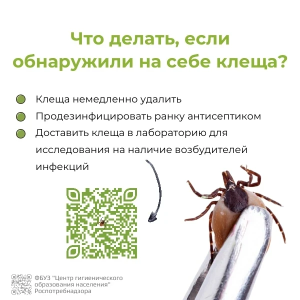 Что делать, если обнаружили на себе клеща?

#мошковскаяоши