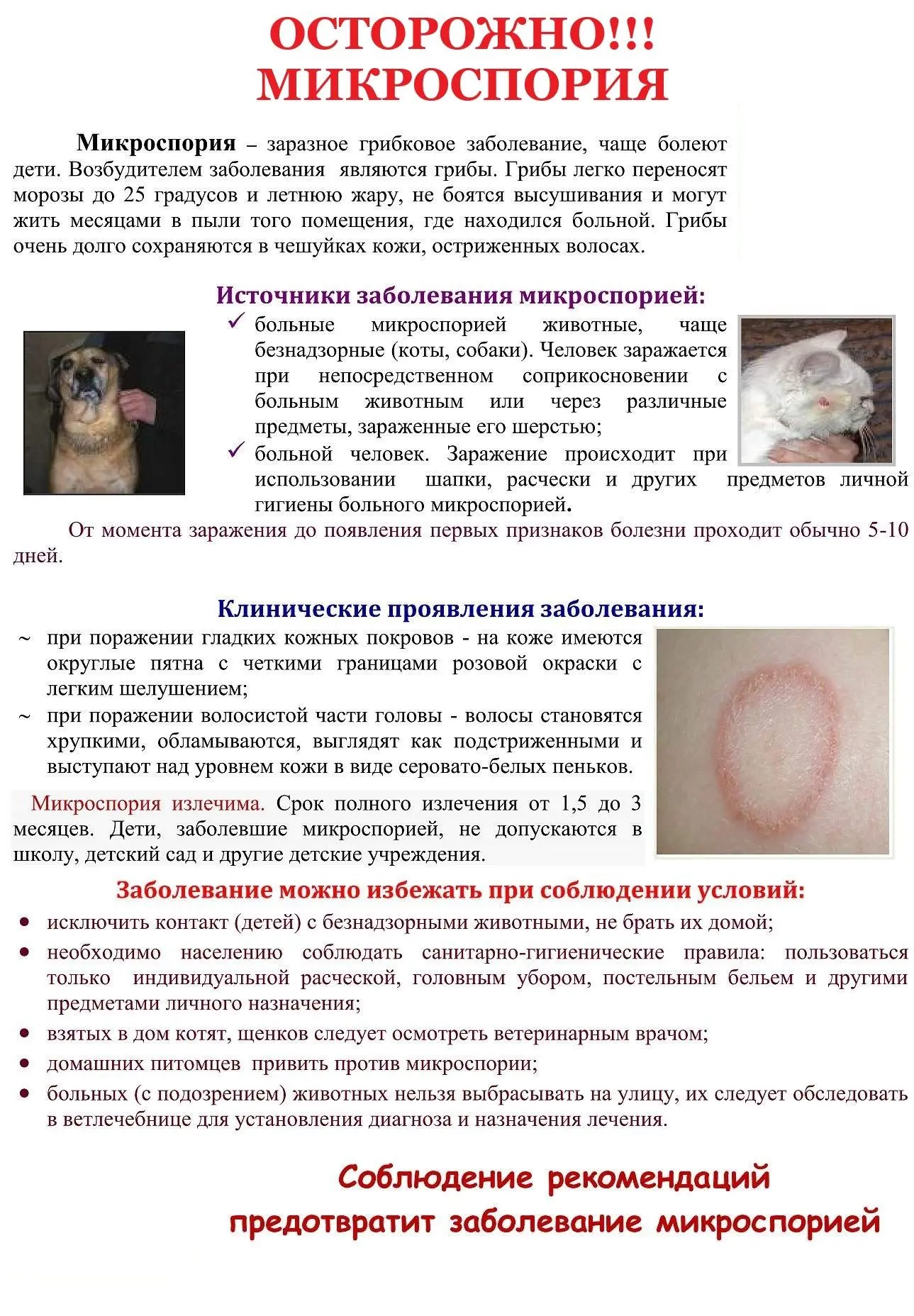 Осторожно, микроспория!
 
Начался сезонный подъём заболеваемости микроспорией.
Микроспория или стриг