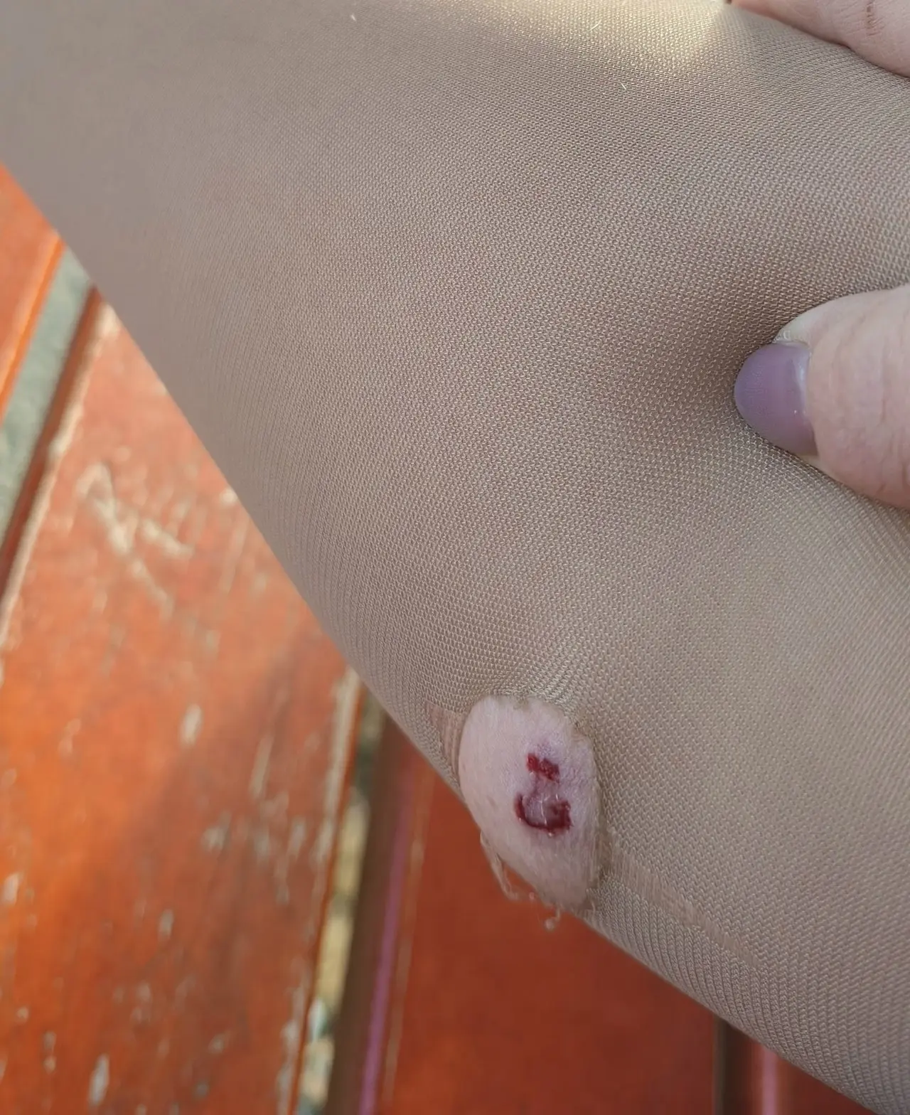 😨 В районе Ангальского мыса, около магазина, орудует стая собак.