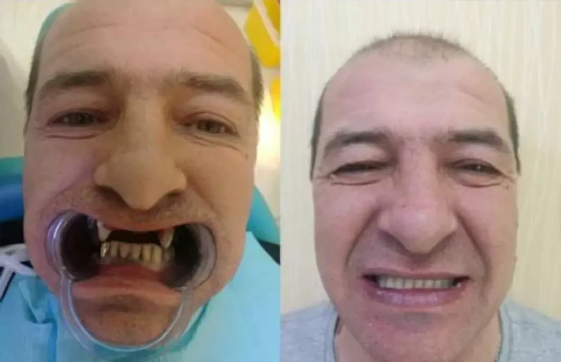 Рубрика до и после