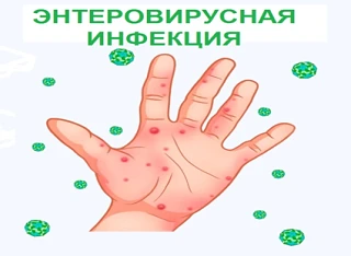 Внимание! Открыта «горячая линия» по вопросам профилактики
энтеровирусной инфекции
С 27 июля по 07 а
