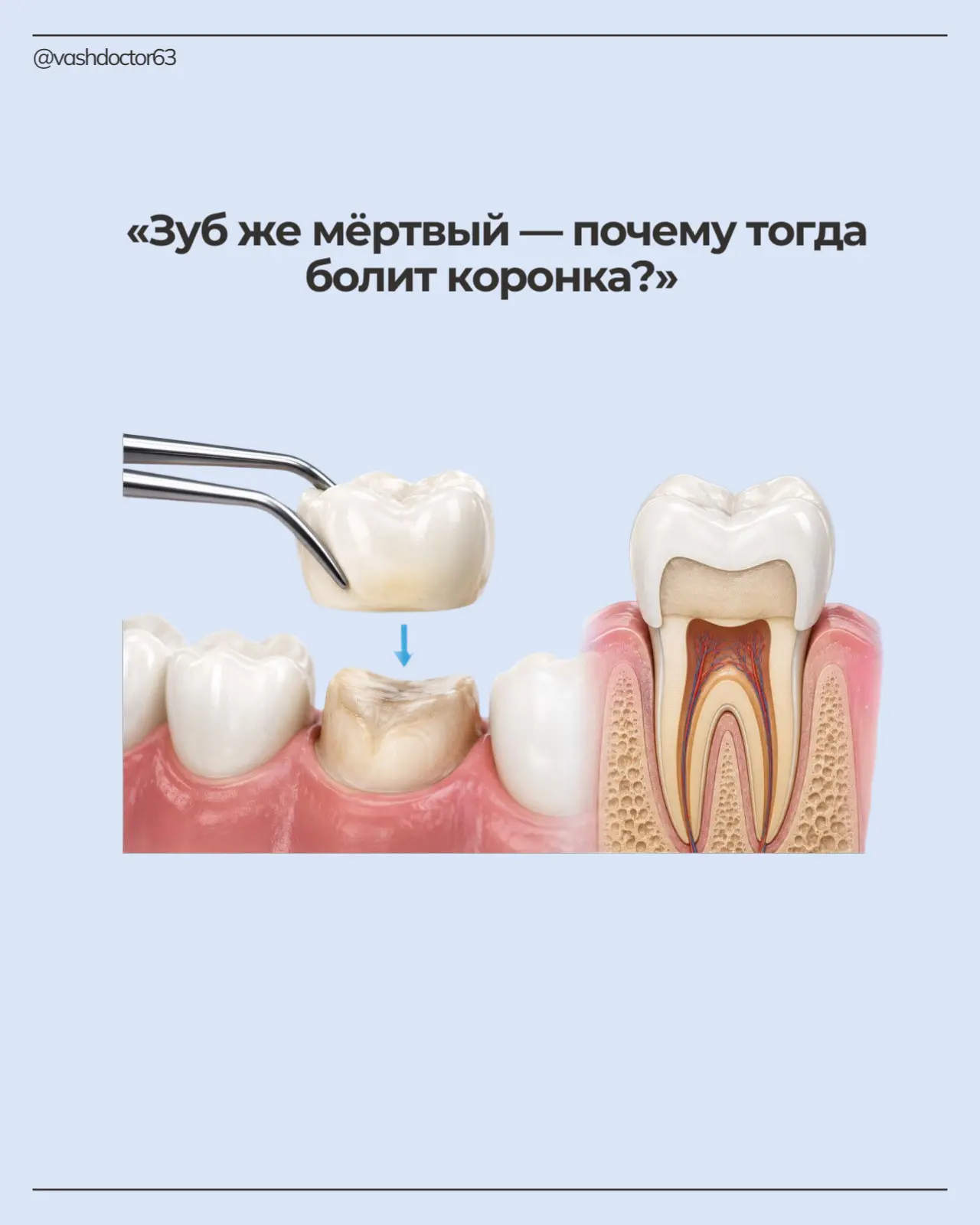 Один из частых вопросов пациентов: