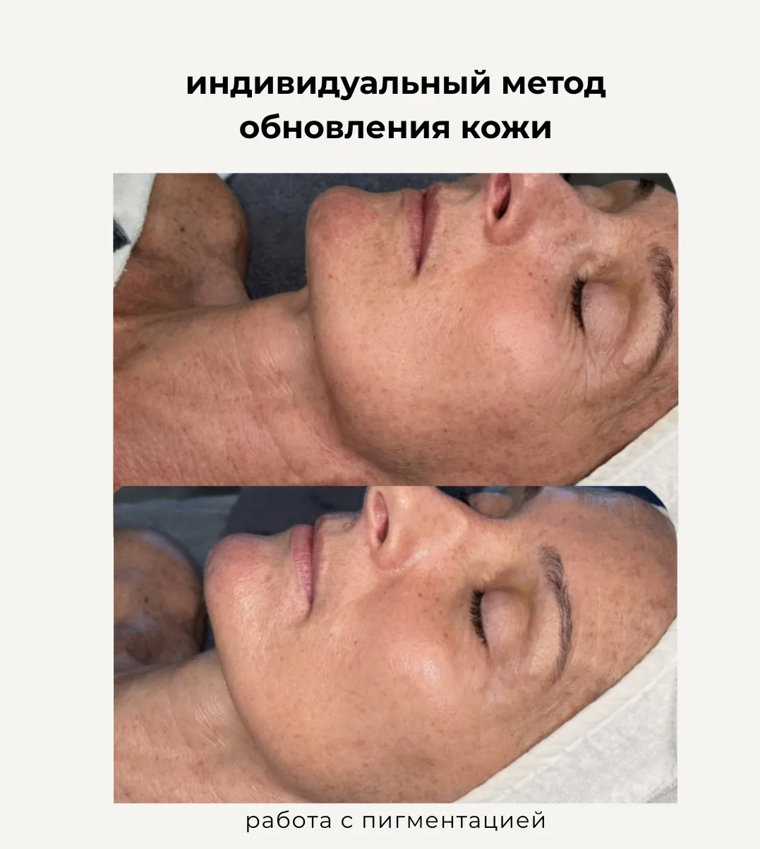 💧 Пилинг нового поколения для кожи, которая заслуживает лучшего ухода

pHpeel ЯНЕА — профессиональн