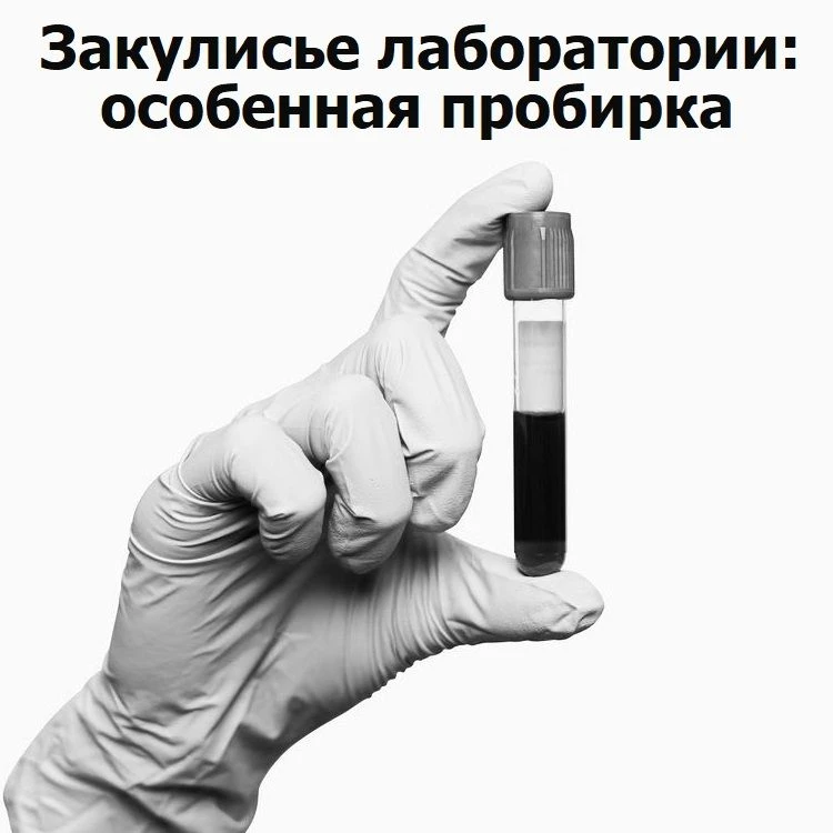🔬Закулисье лаборатории: особенная пробирка