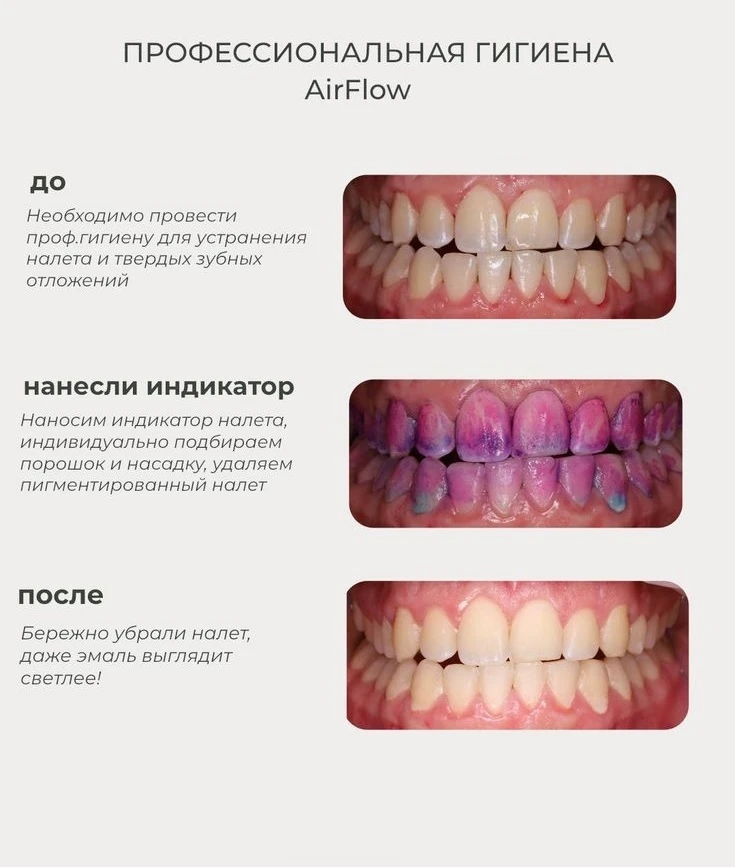 🎁 Специальное предложение для наших подписчиков!