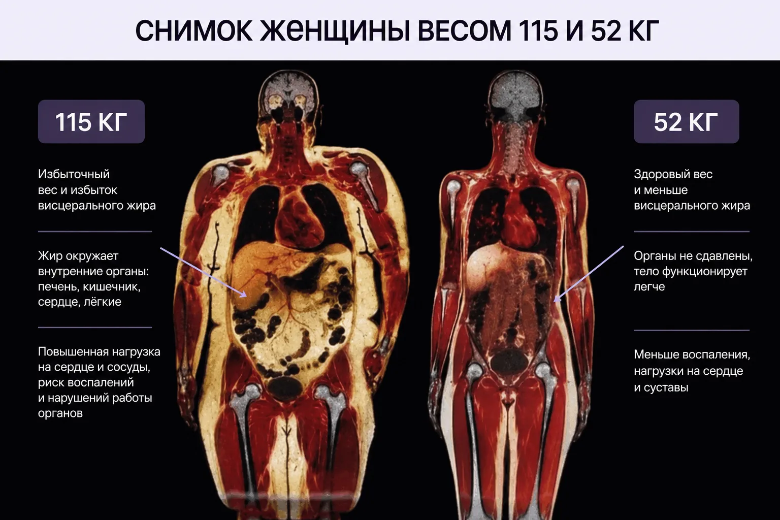Как выглядит лишний вес внутри тела? 😳