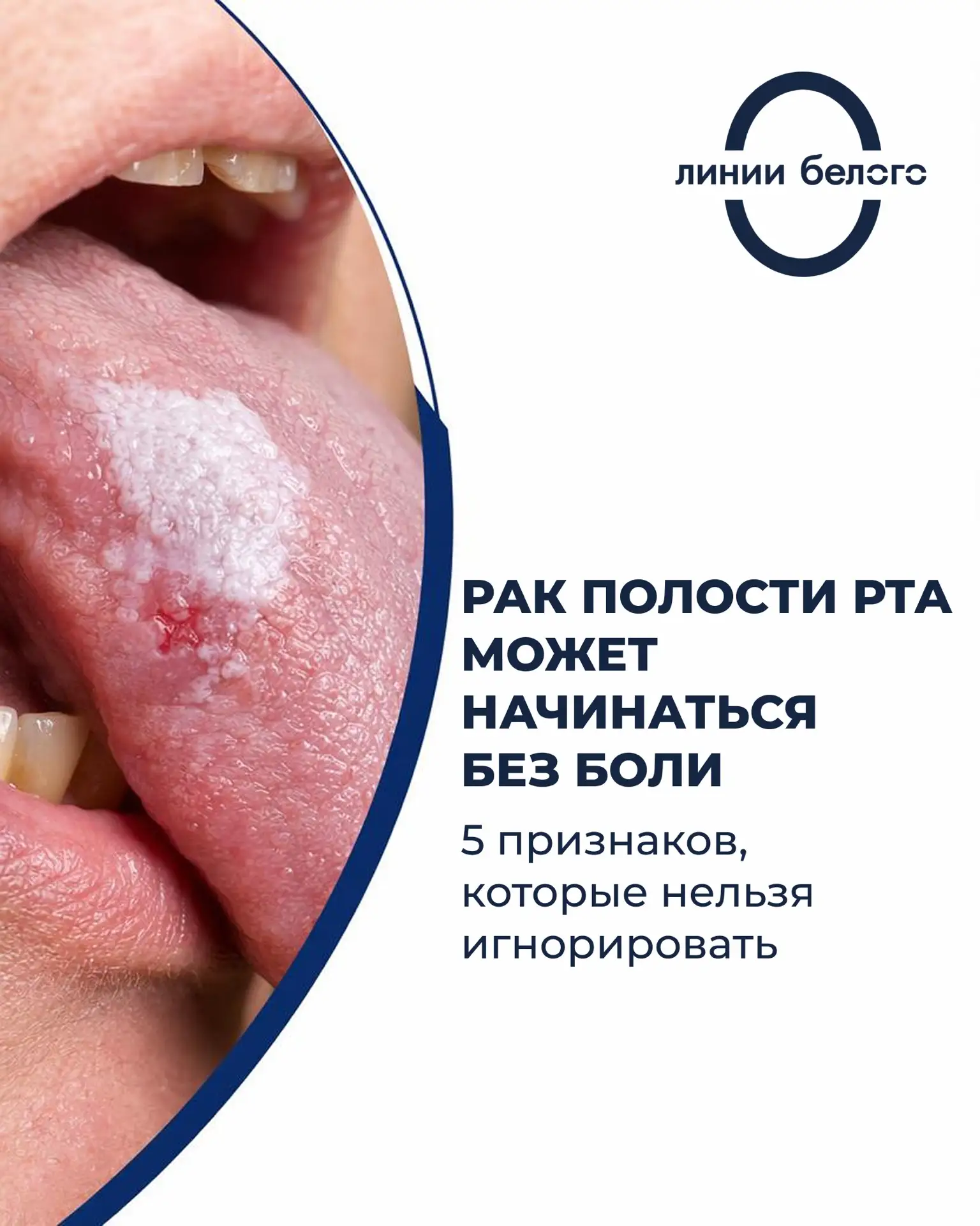 ☝️Наличие этих признаков не означает онкологию. Но это повод не заниматься самодиагностикой и своевр