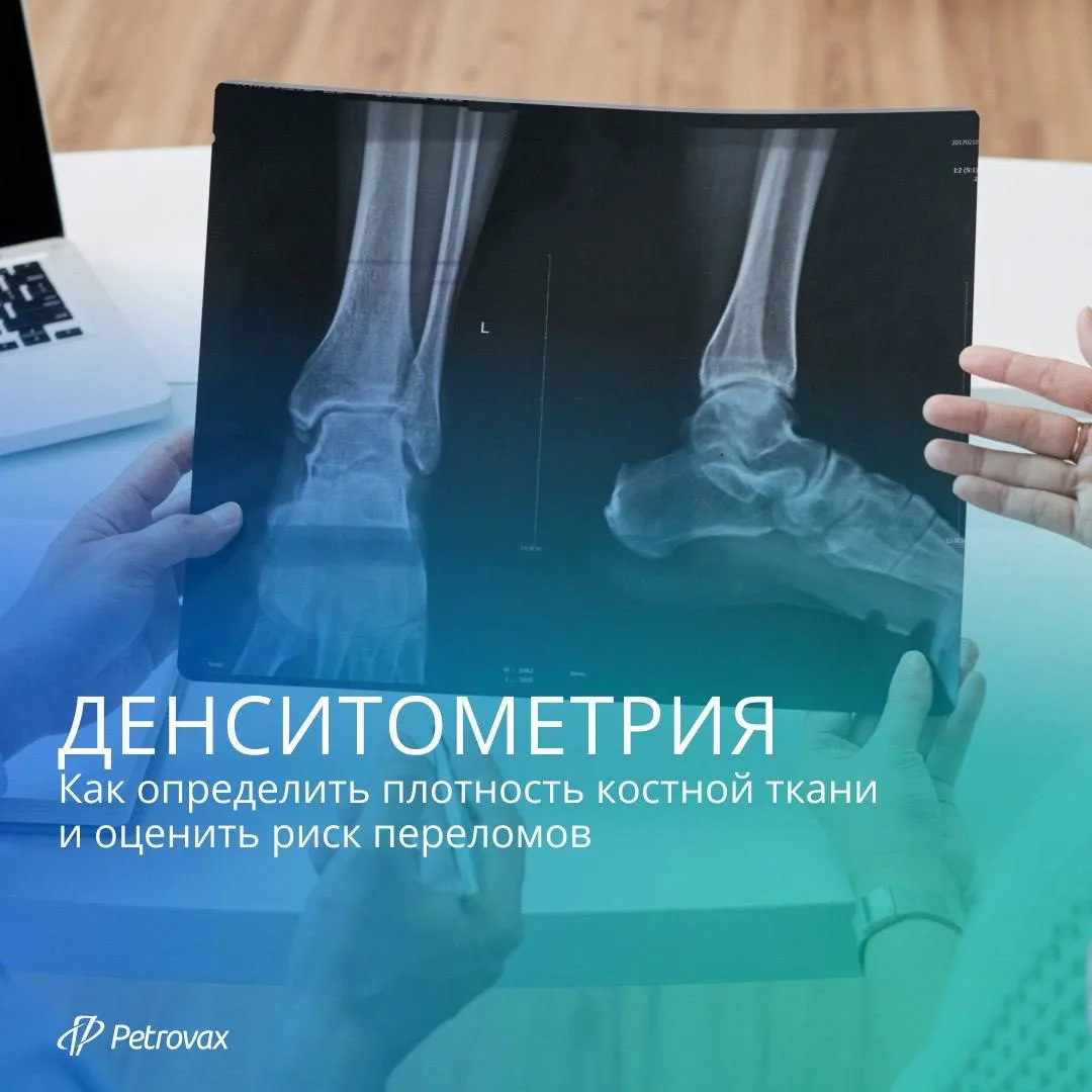 🔬Как определить плотность костной ткани и оценить риск переломов? В этом помогает денс...