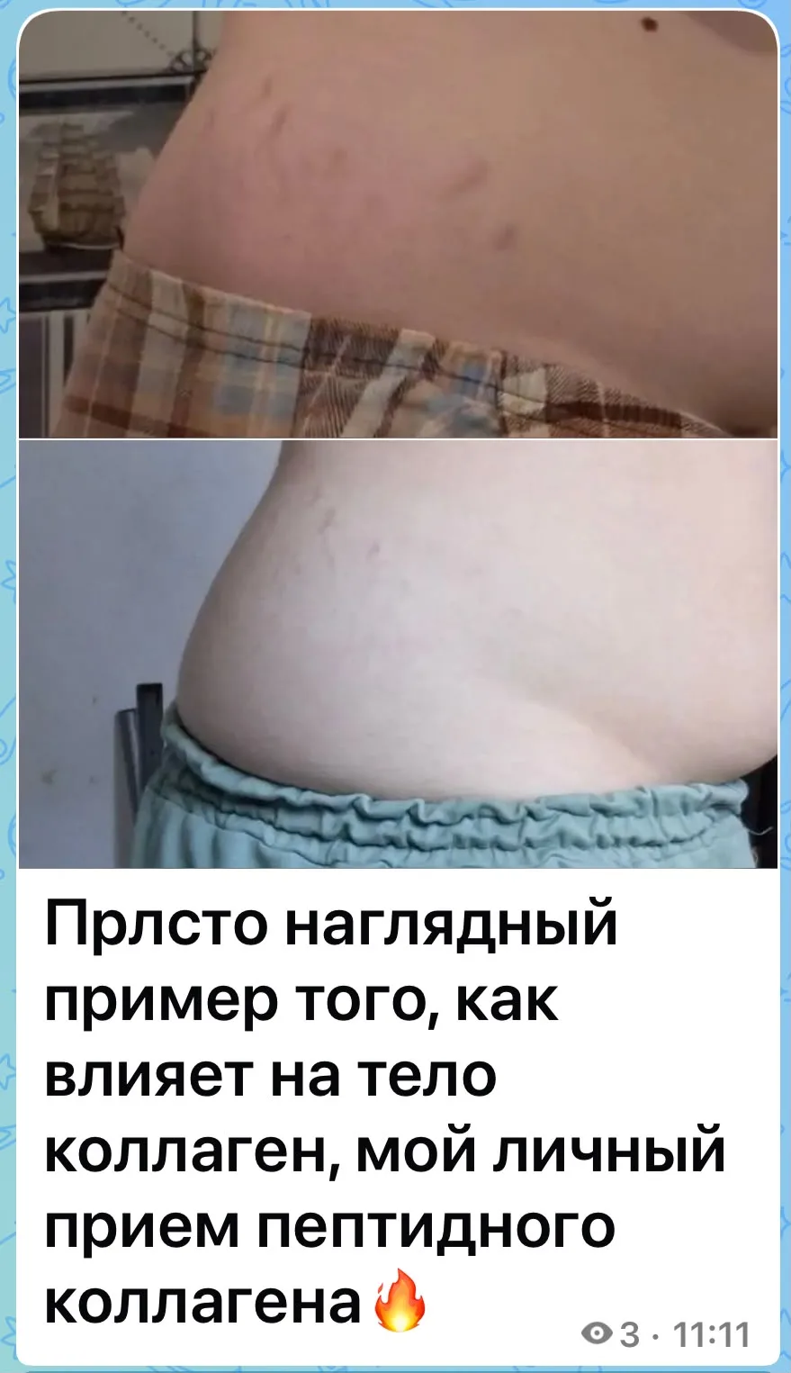 Работает даже в таких случаях. Отзыв клиентки.