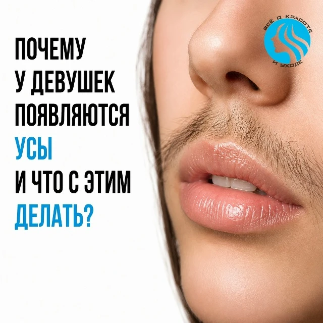 А вы уверены, что «усы» — это просто генетика?