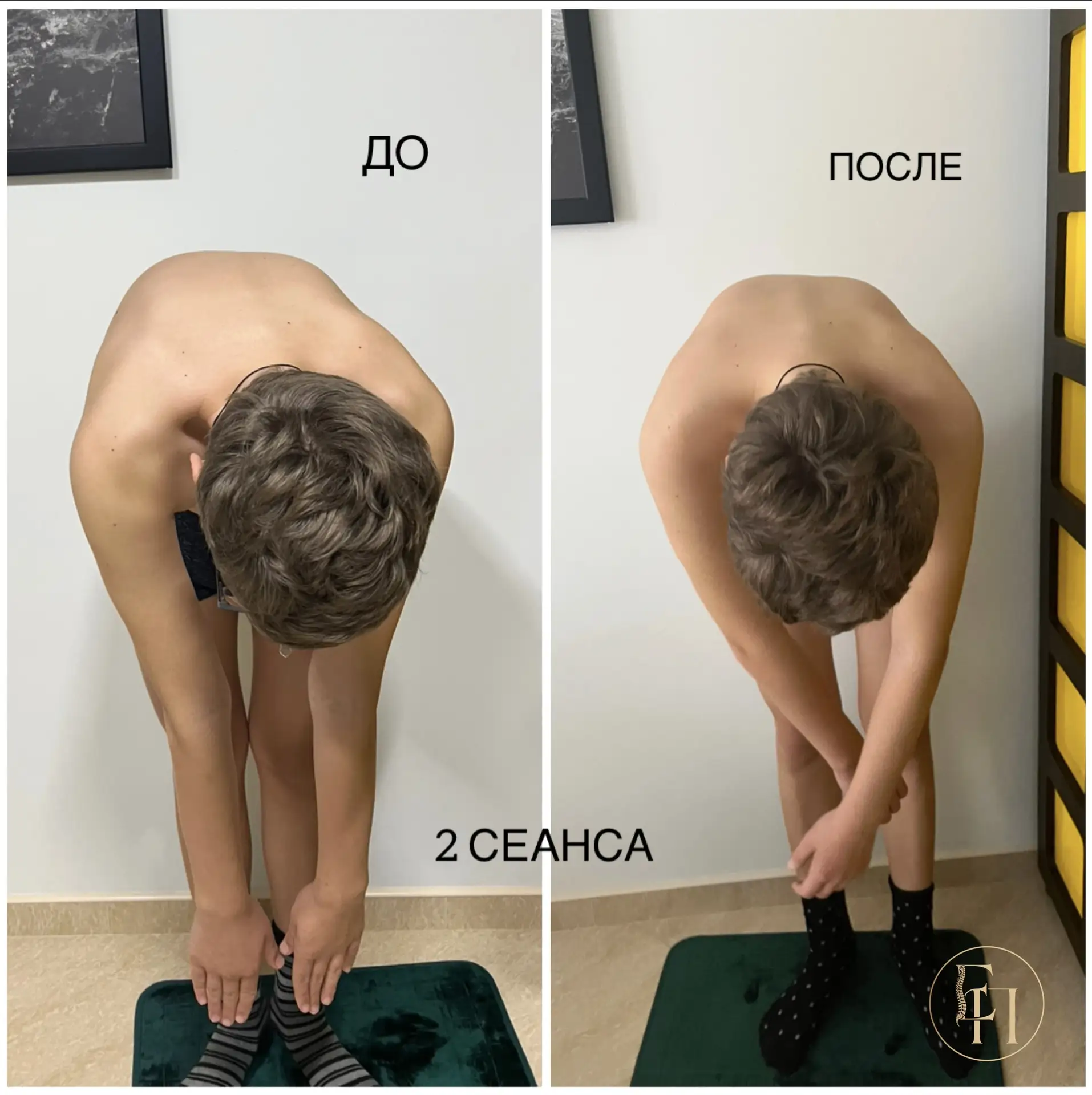 🛑 Тест Адамса: