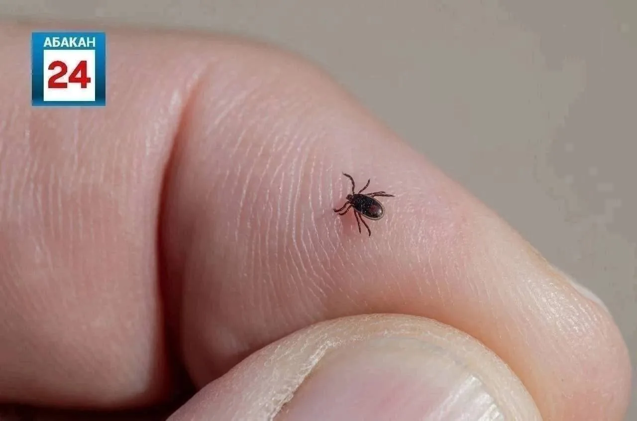 🕷Ребёнок заболел энцефалитом после укуса клеща в Хакасии  Ещё у семерых человек подтвердился боррели