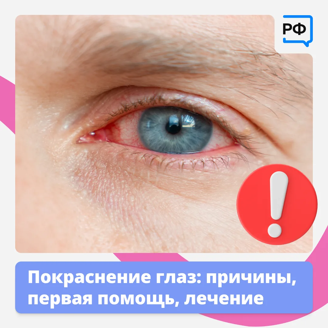 👀 Красные глаза — это красный флаг! Они прямо сигнализируют: пора обратить на них вним...
