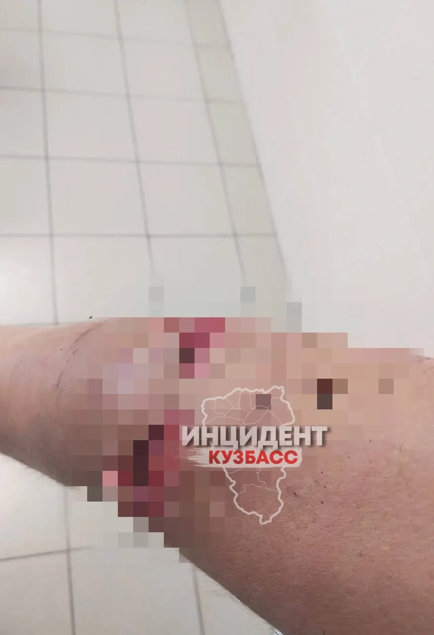 Появились фотографии пострадавшего мужчины, который влетел в витрину в новокузнецком ТЦ