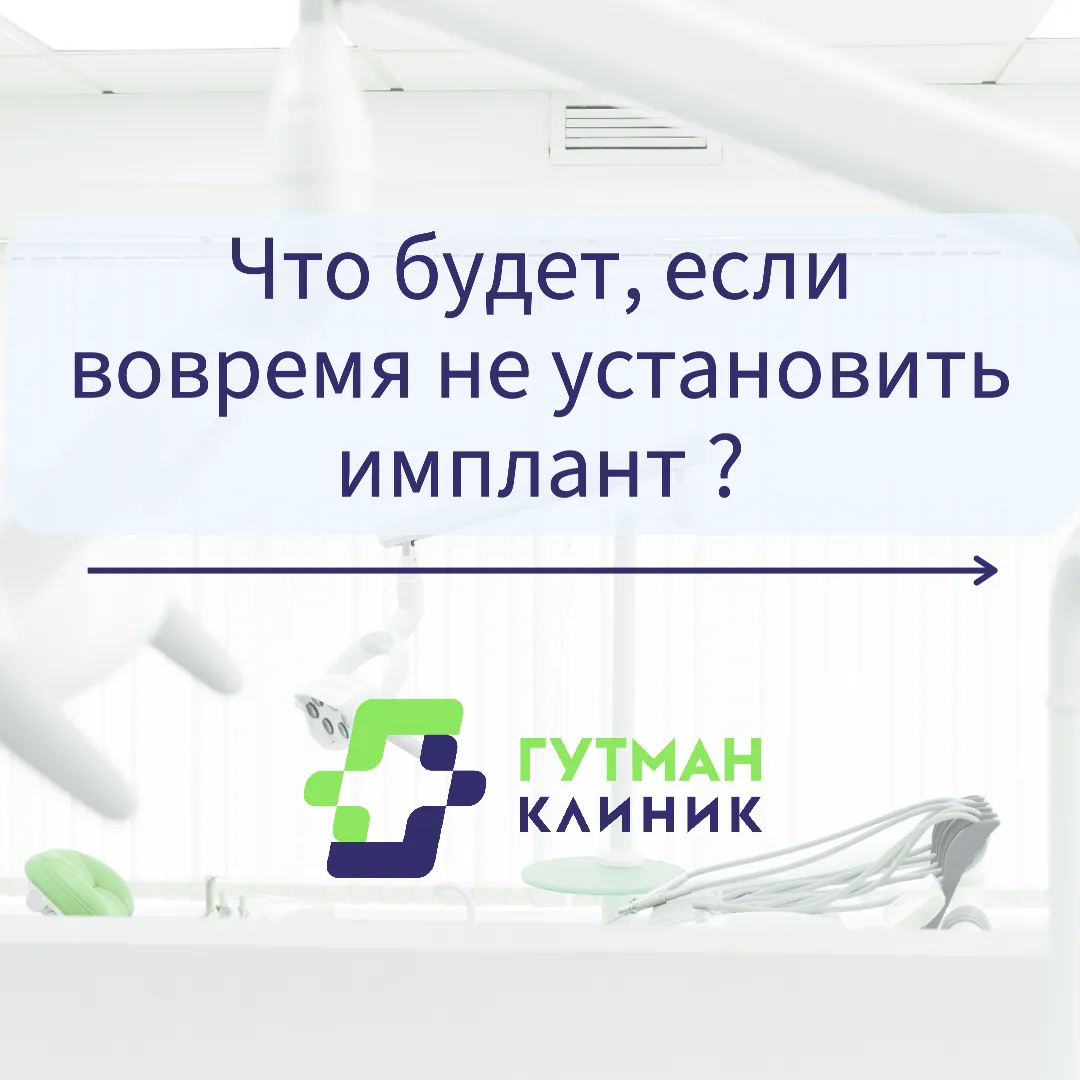 Почему важно установить имплантат вовремя?
