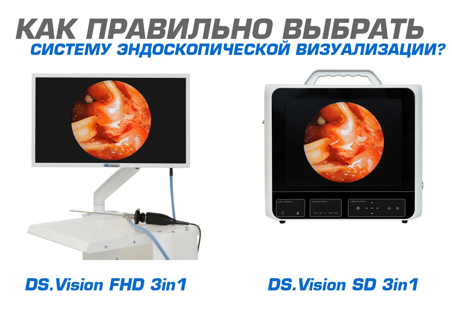 Какую систему эндоскопической визуализации выбрать под свои задачи: DS.Vision SD или DS.Vision FHD?
