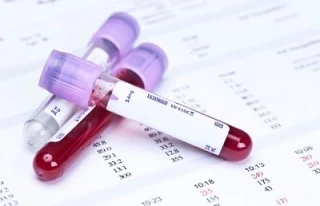 🏥 Практические шаги

🩺 Хотите проверить своё здоровье, но не знаете, с чего начать? Рассказываем, 