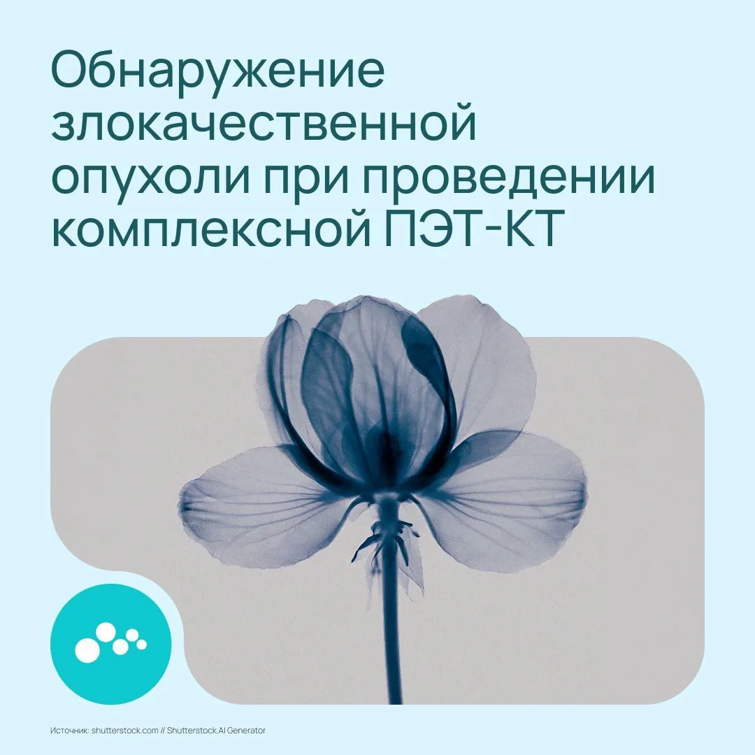 Иногда обследование назначают по одной причине, но во время диагностики обнаруживается другая пробле