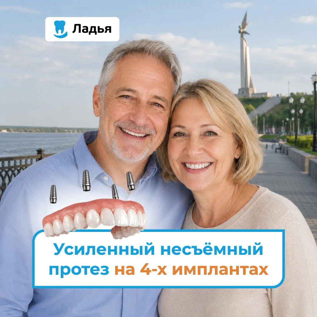 Восстановление всех зубов! Такси до дома после операции!