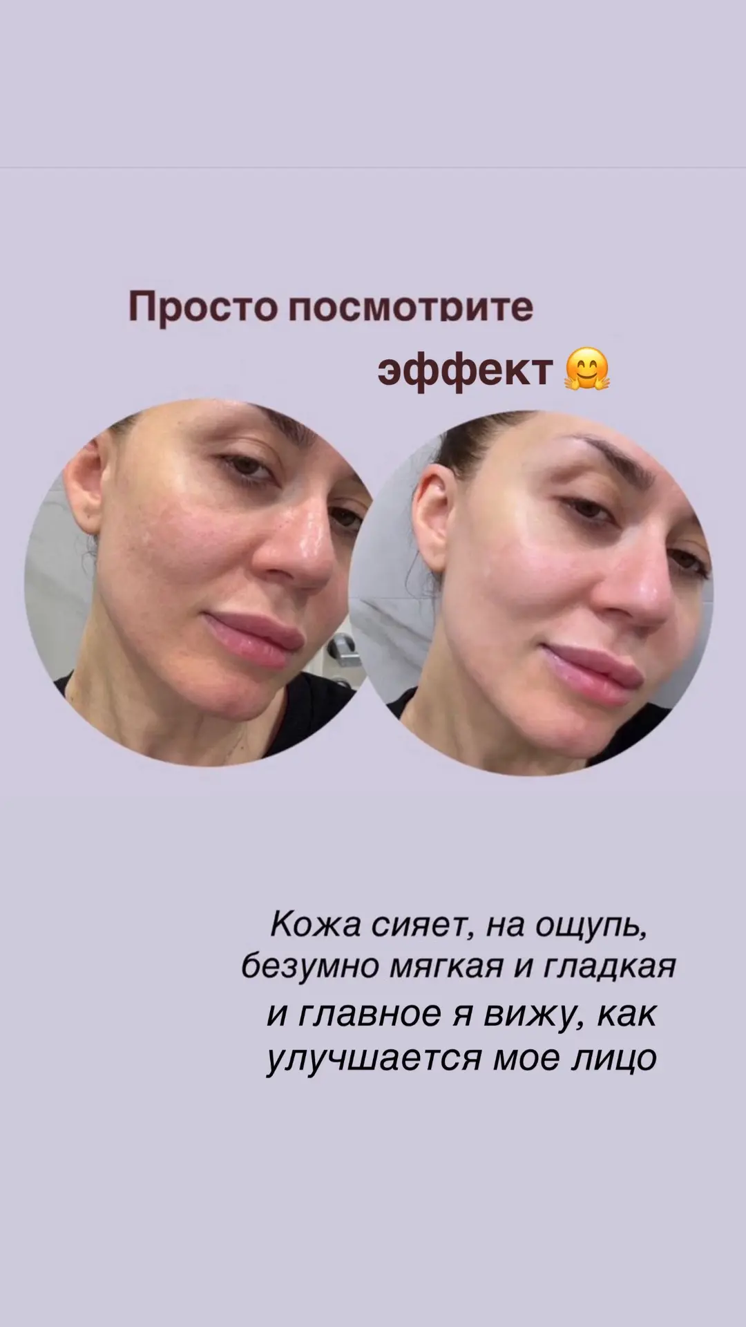 Девочки, если вы пока не готовы к уколам красоты, но чувствуете, что коже уже нужен бол...