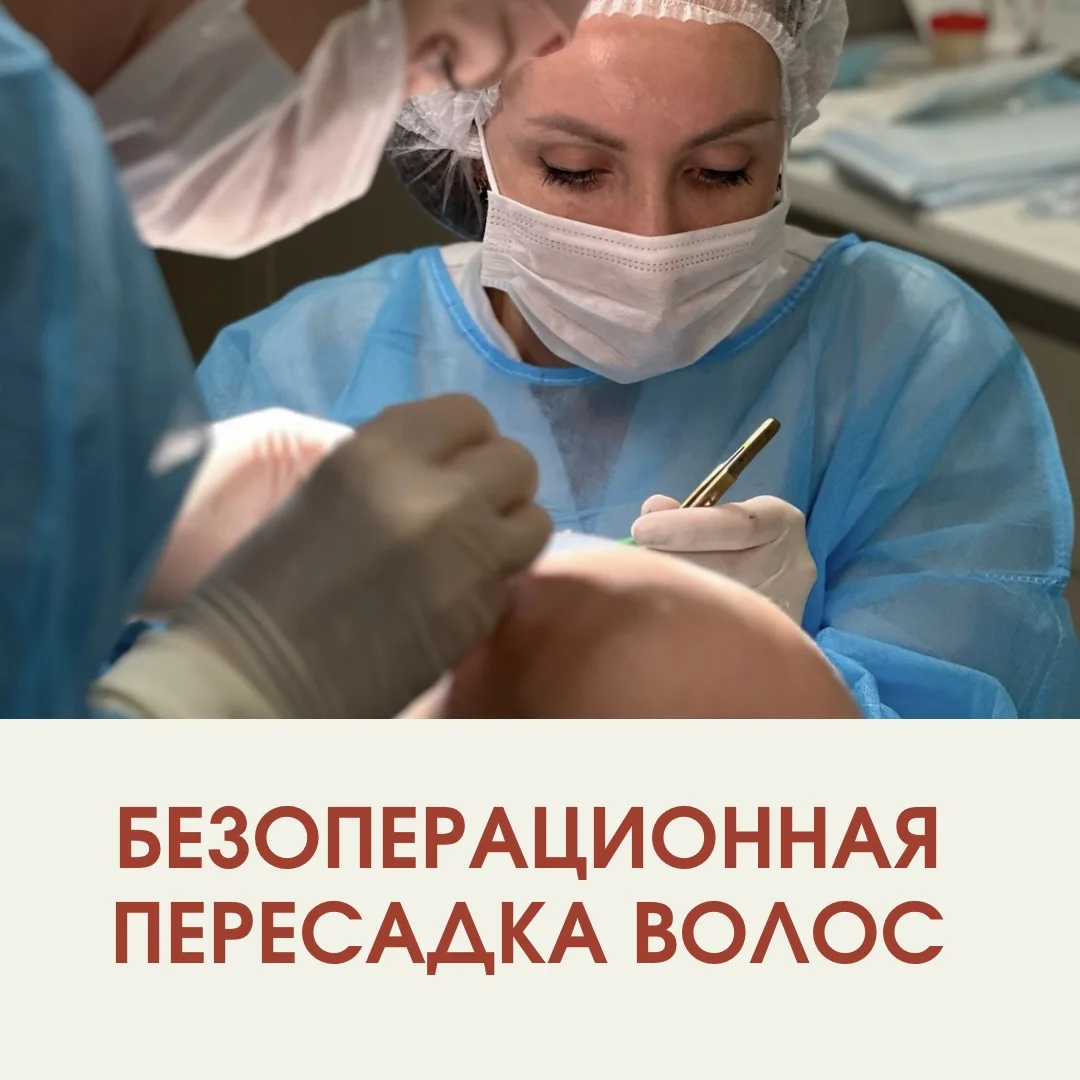 ПЕРЕСАДКА ВОЛОС В ПЕРМИ! 🔥