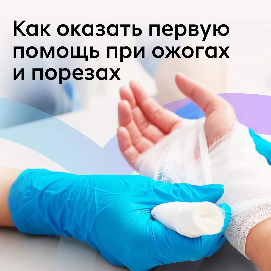 🎄 Фейерверки, горячая сковорода во время приготовления фирменных блюд, случайно разбитая посуда… Нов
