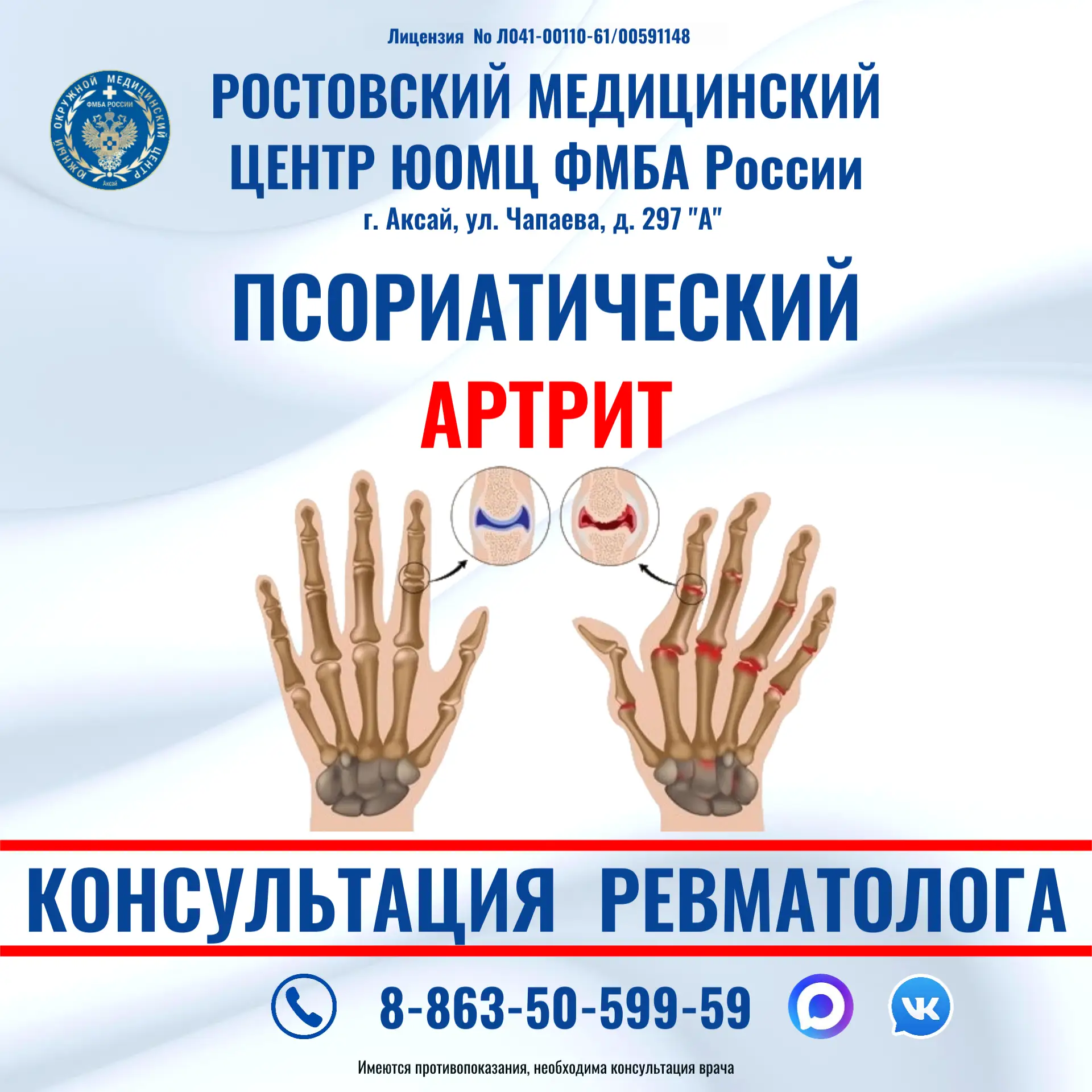 Псориатический артрит — это хроническое воспаление суставов, возникающее на фоне длительного течения