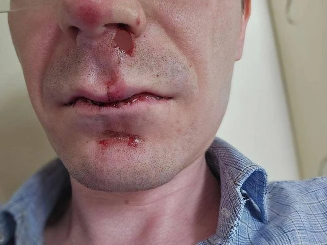 Цепью и металлическим прутом банда подростков избила двоих мужчин в Перми. 

Это случилось утром в ц
