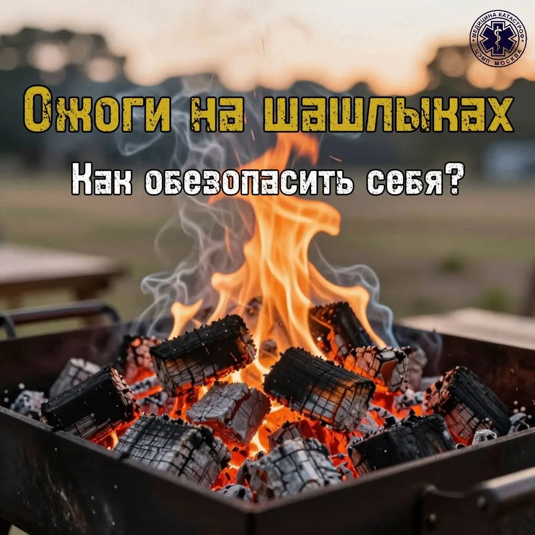 ➕ Что делать, если вы обожглись на шашлыках?