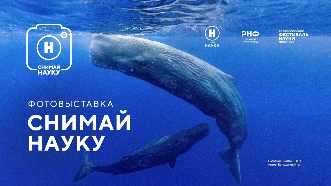 Молекулярный витраж и яйцо бабочки в электронном микроскопе: выставка «Снимай науку!» в...