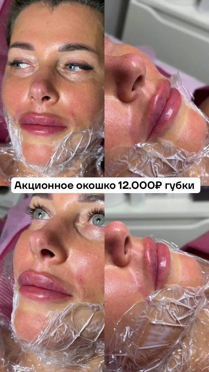 Приглашаем вас в уютную студию эстетики лица и тела Коллаген Лаб. Мы работаем уже 4 год...