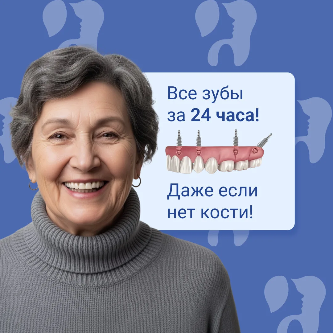 Бережная имплантация всех зубов за 1 день в Самаре!