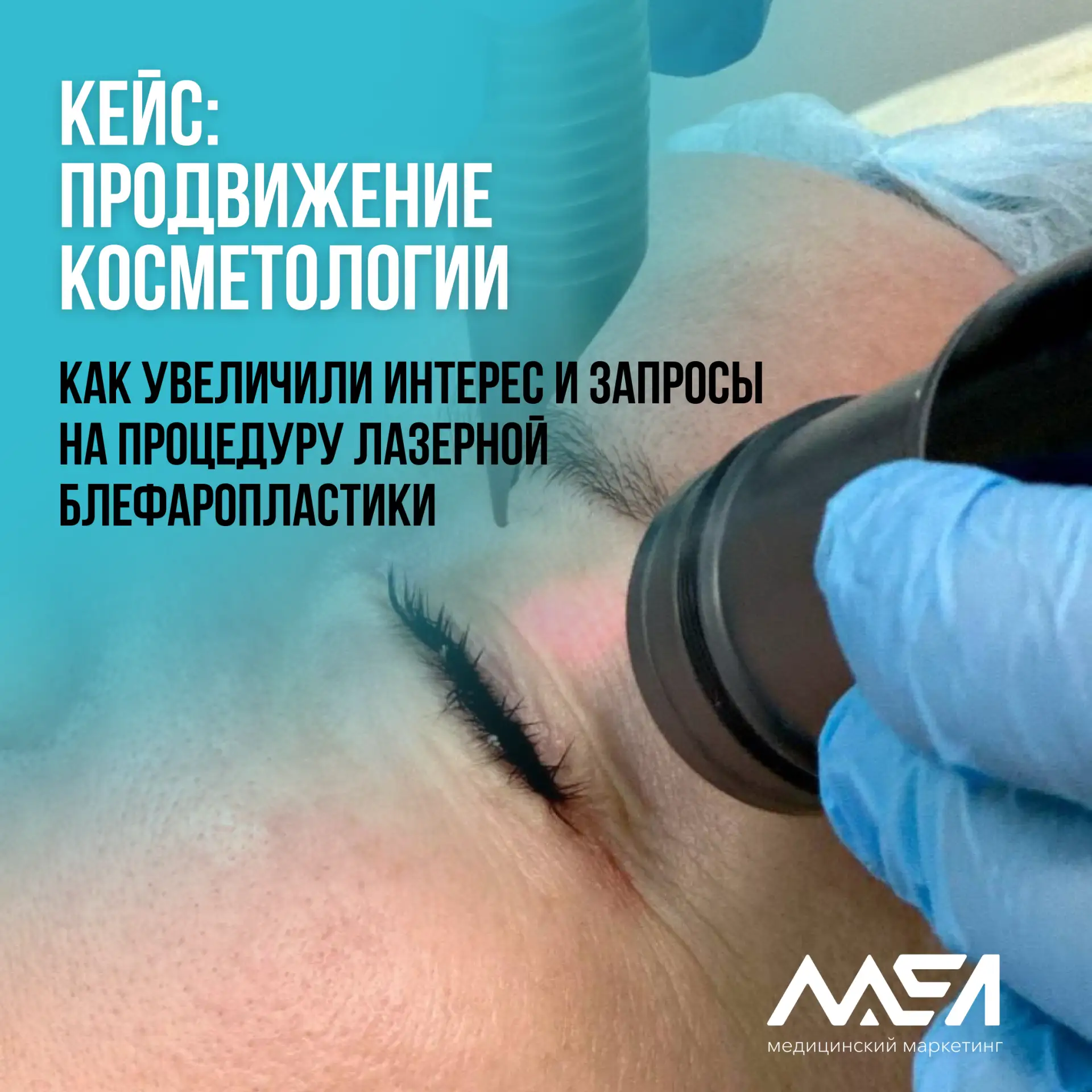 Кейс.