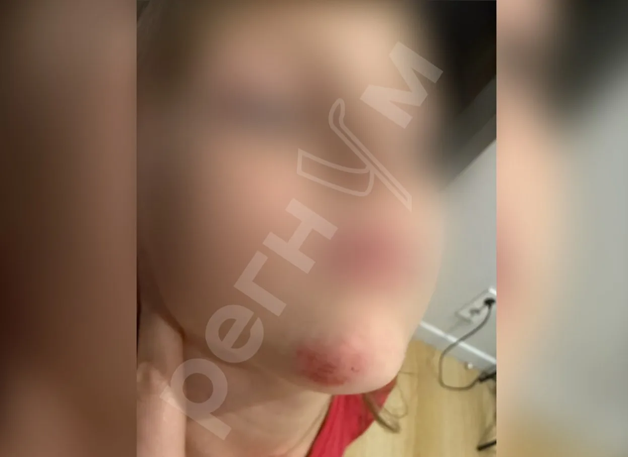 В московском парке Фили двое подростков на одном самокате сбили 5-летнюю девочку на пеш...