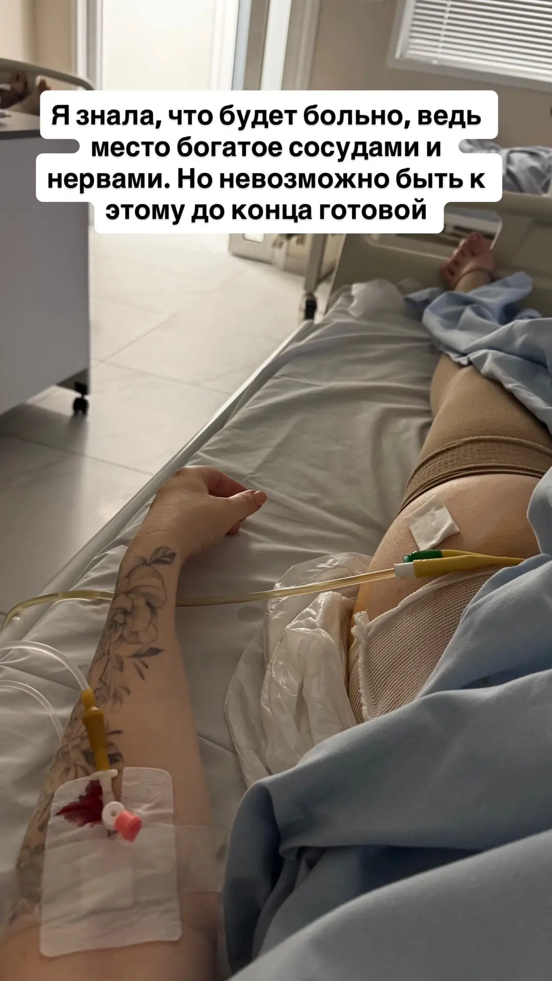 1 день после операции, ощущения конечно странные, я думала что будет больно, но к этому...