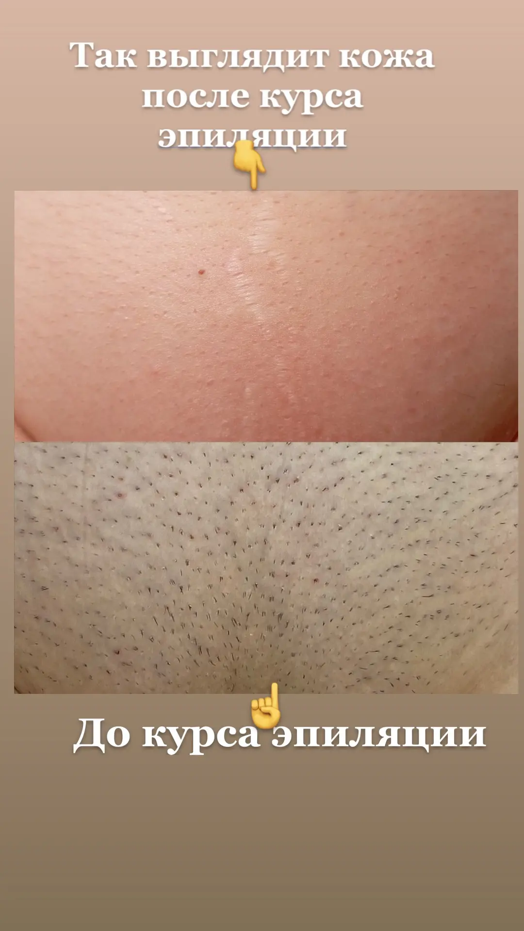 #элосэпиляция
#гладкоетело
#элосраменское