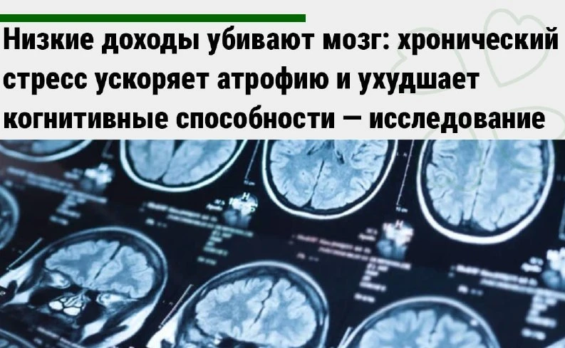 Низкие доходы убивают мозг: хронический стресс ускоряет атрофию и ухудшает когнитивные ...