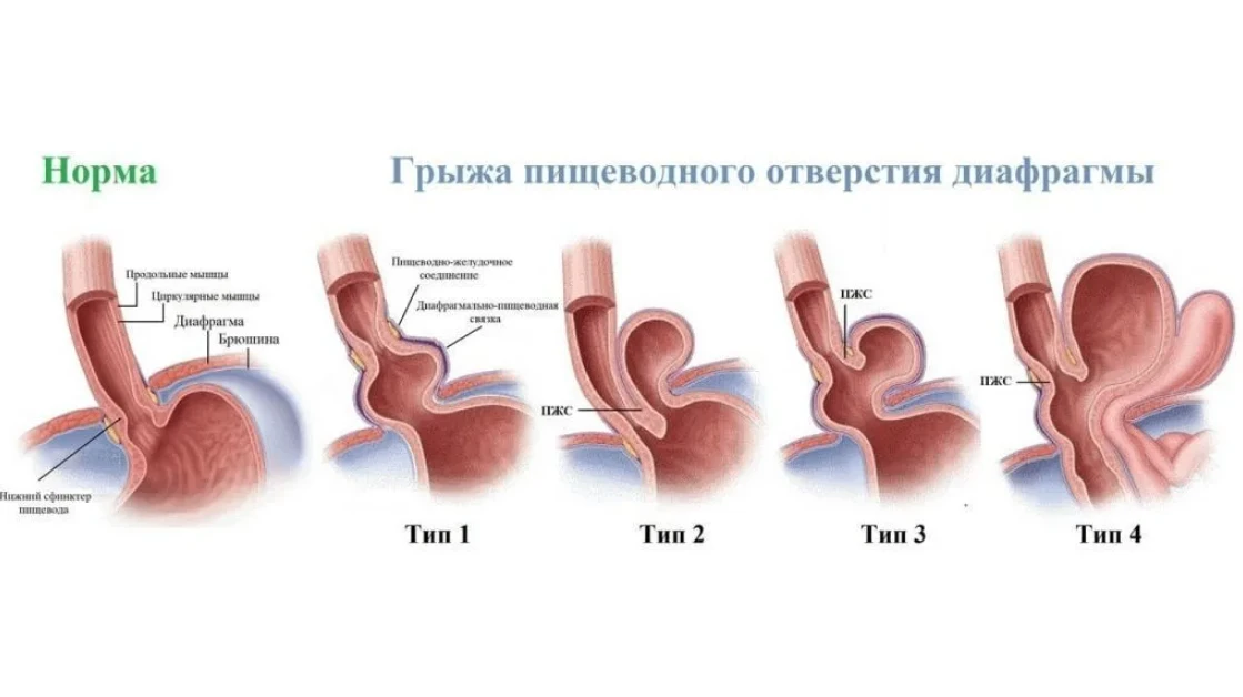 Что еще за ГПОД?🤔
