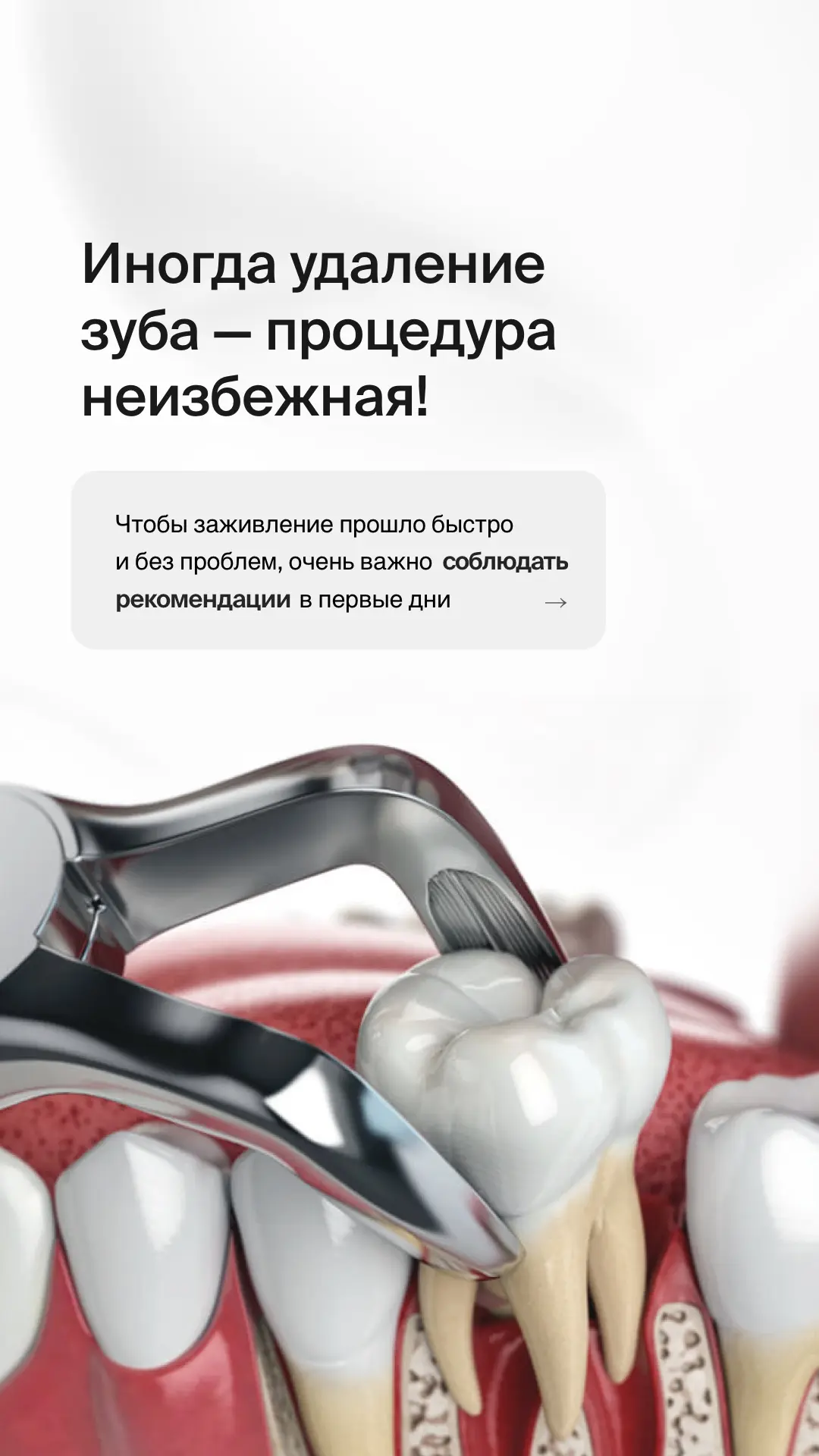 📌 ЧТО НЕЛЬЗЯ ДЕЛАТЬ ПОСЛЕ УДАЛЕНИЯ ЗУБА?