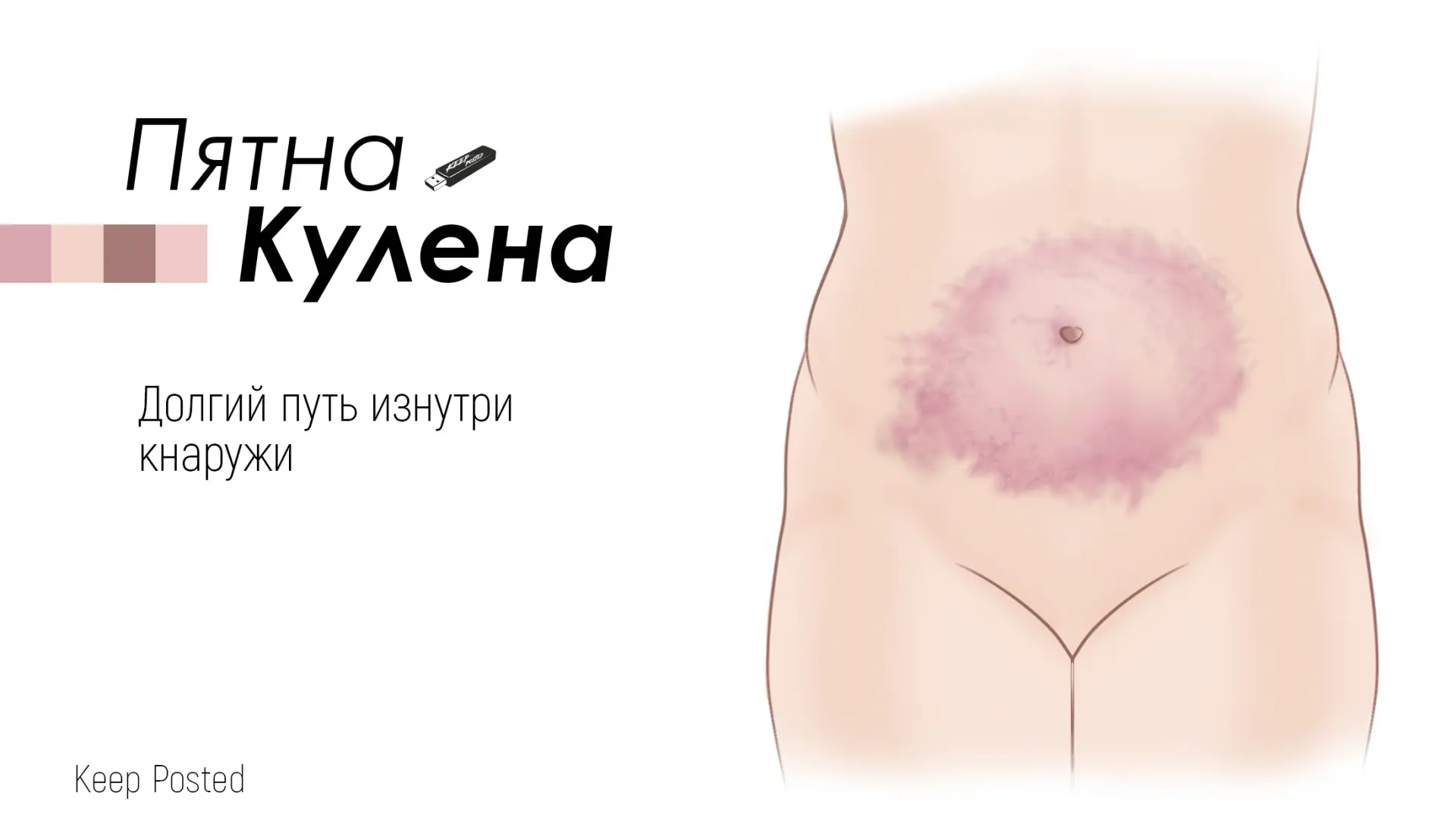 В крайнем опросе (https://vk.ru/keep__posted?w=wall-188359135_115) о пятнах около 30% у...