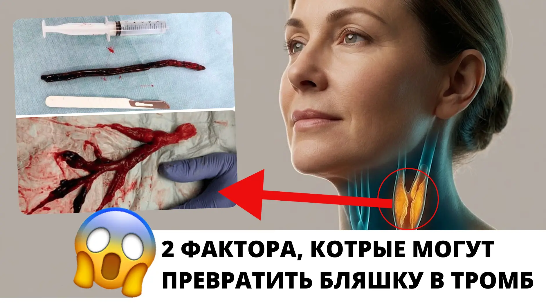 🫀2 неожиданных фактора, которые могут «сорвать» холестериновую бляшку

Выступил холодный пот, онеме