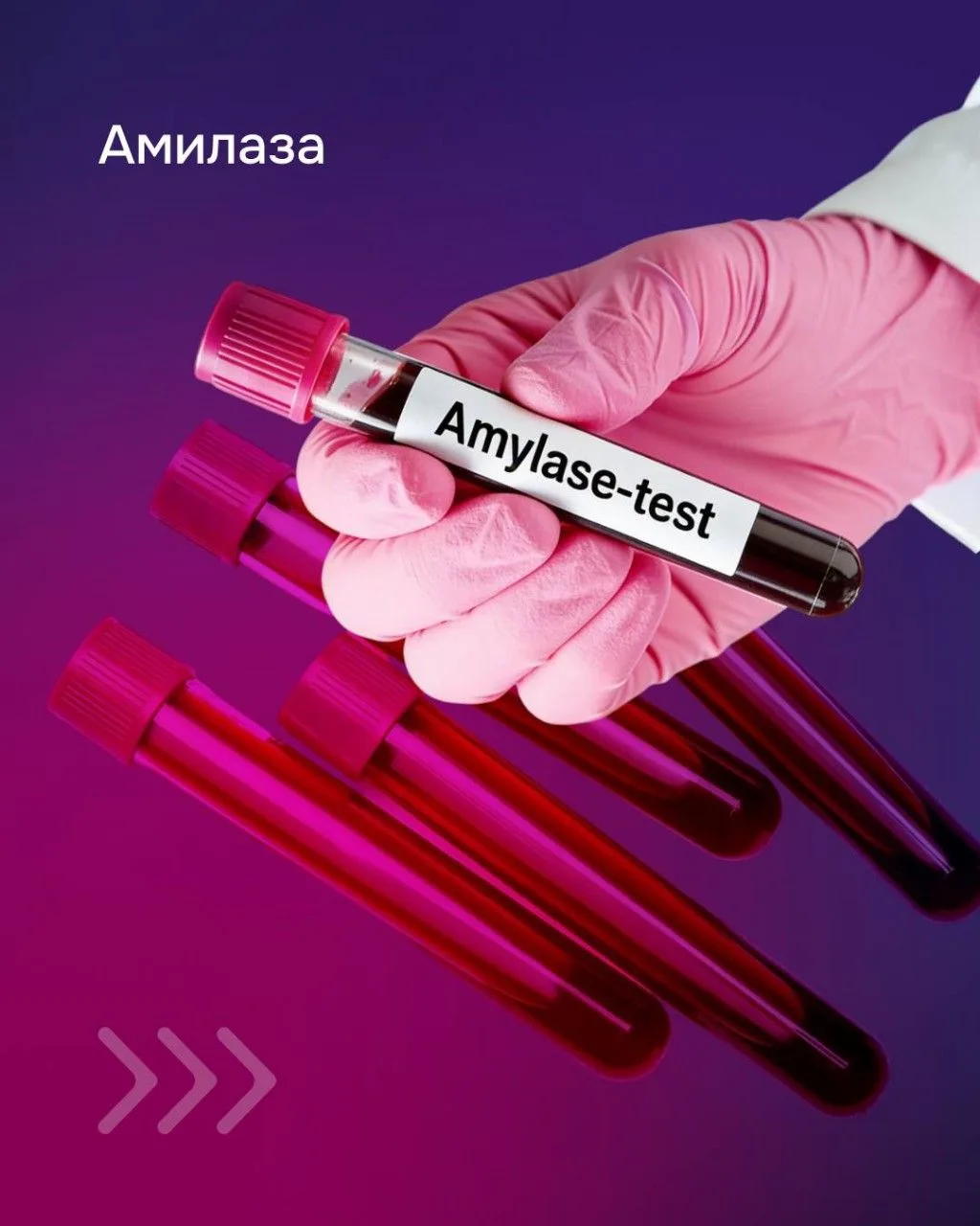 Ферменты поджелудочной железы: кто наиболее специфичен?