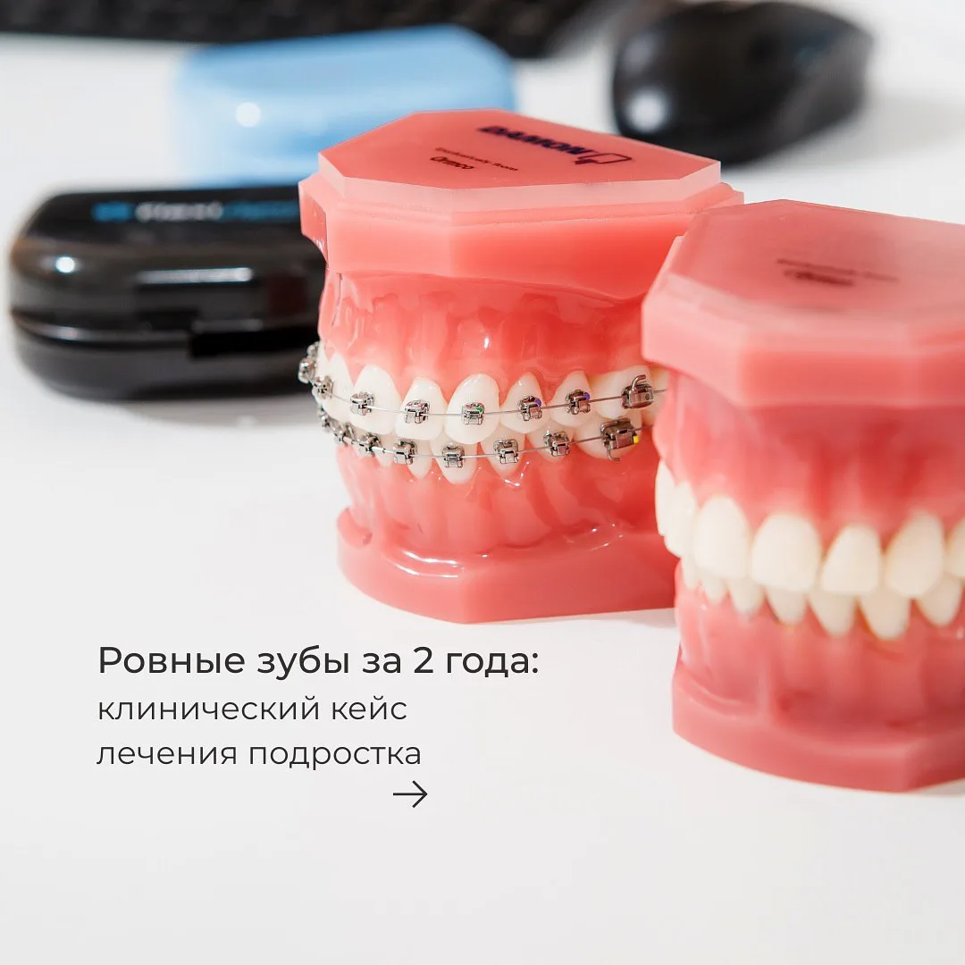 Пациент — подросток, спортсмен.