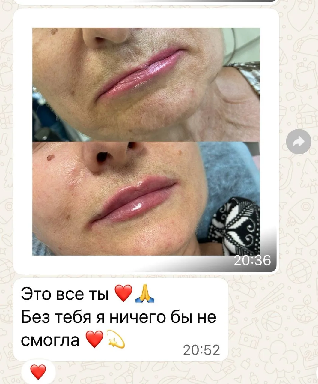 «Я не хочу увеличивать губы»