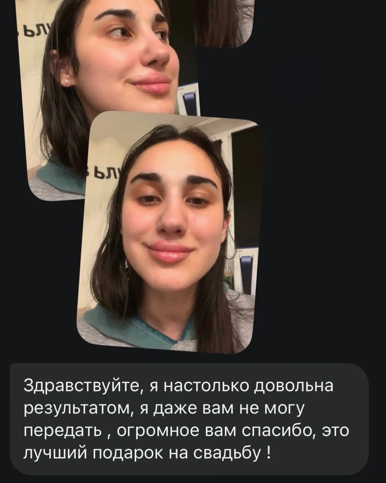 КОГДА ПАЦИЕНТ ДОВОЛЕН РЕЗУЛЬТАТОМ – ГЛАВНЫЙ КРИТЕРИЙ НАШЕЙ РАБОТЫ 👏