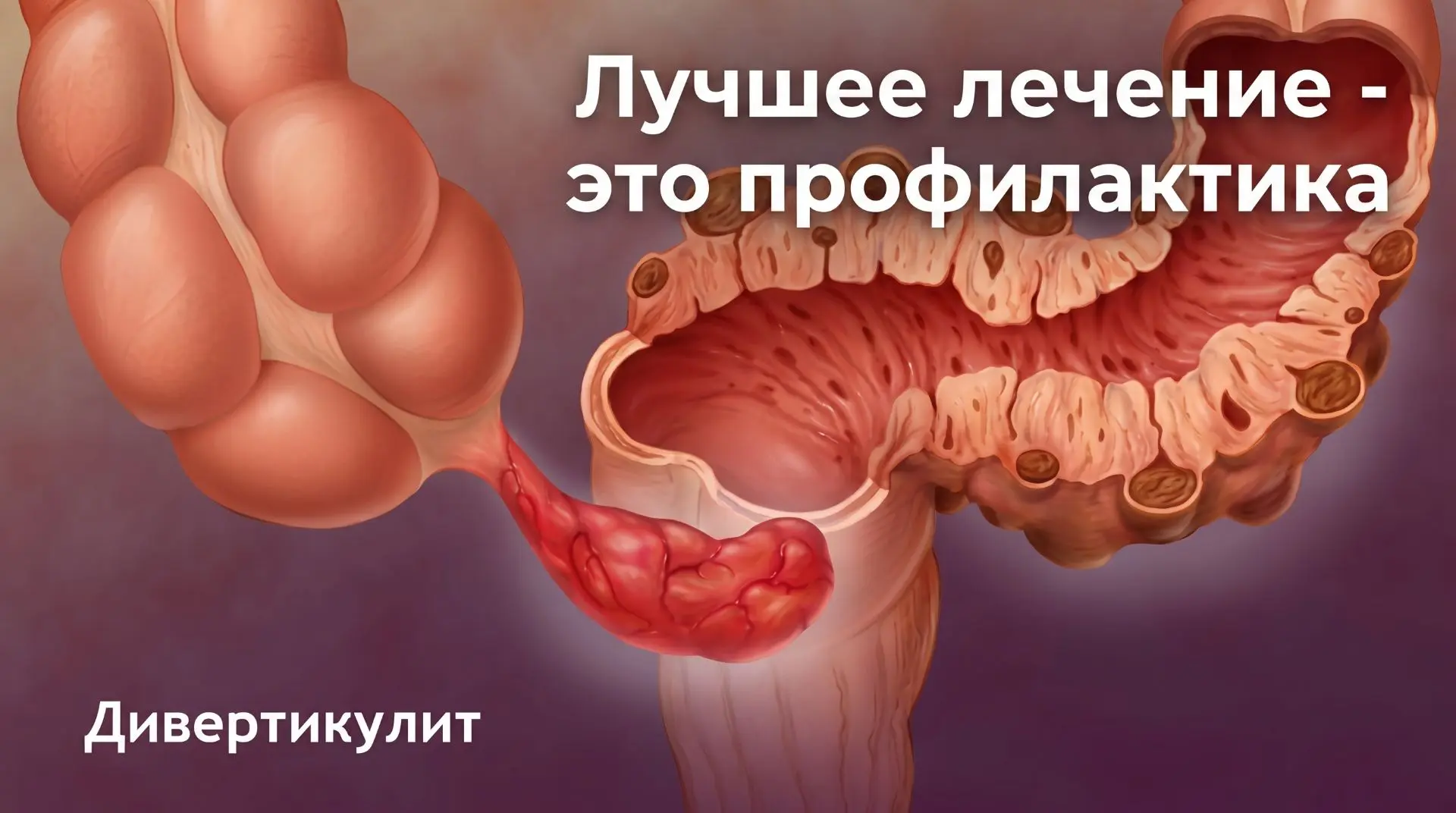 Лучшее лечение болезни — это конечно же профилактика, чего я не делала в своё время. Не...