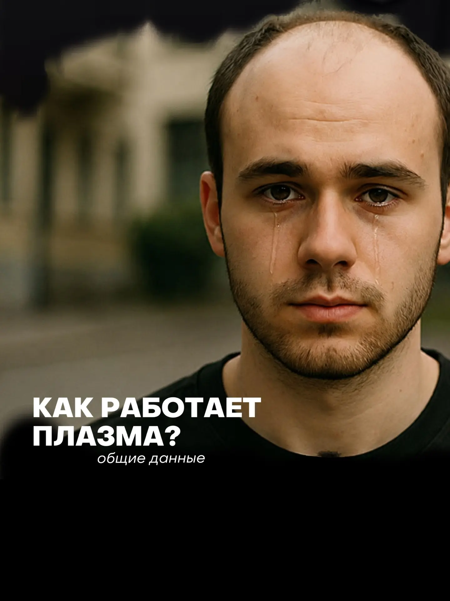В нашем профиле мы поделились роликом о плазмотерапии волосистой части головы.