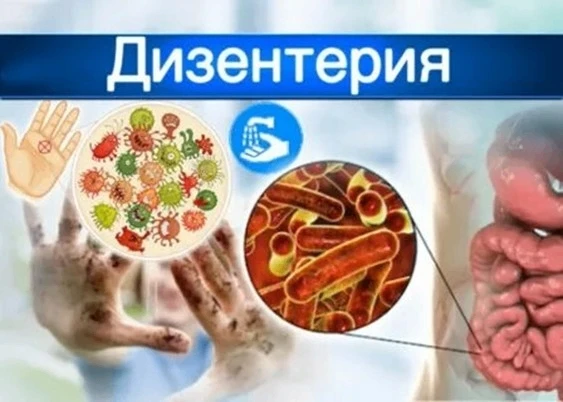 Дизентерия – это острая кишечная инфекция, возбудителем который является особый вид бак...